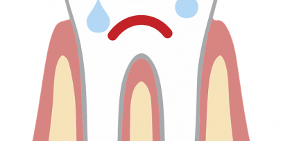 Ilustración de un molar con cara llorando. Imagen de dominio público. 