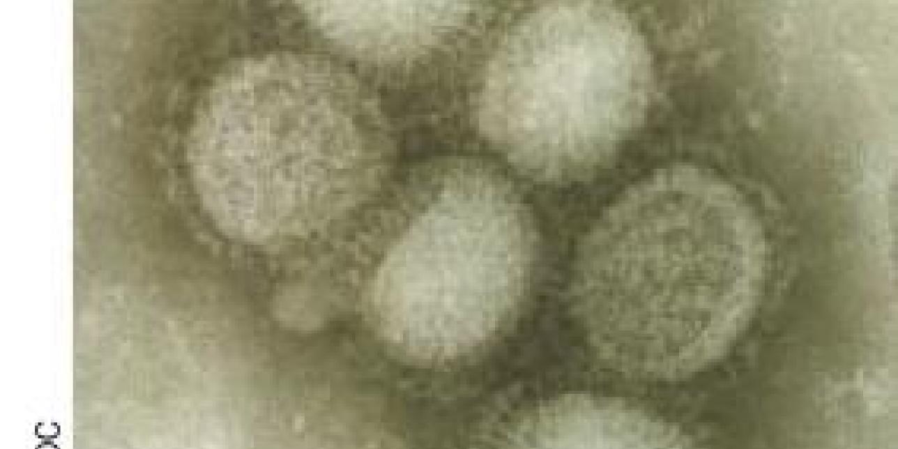 Imagen del virus al microscopio