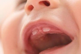 Bebé