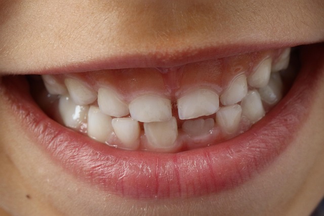 Dientes de mujer
