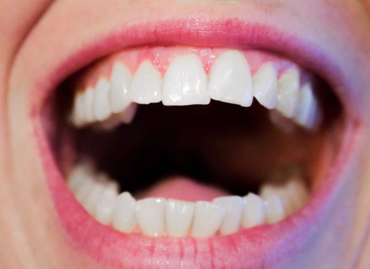 dientes