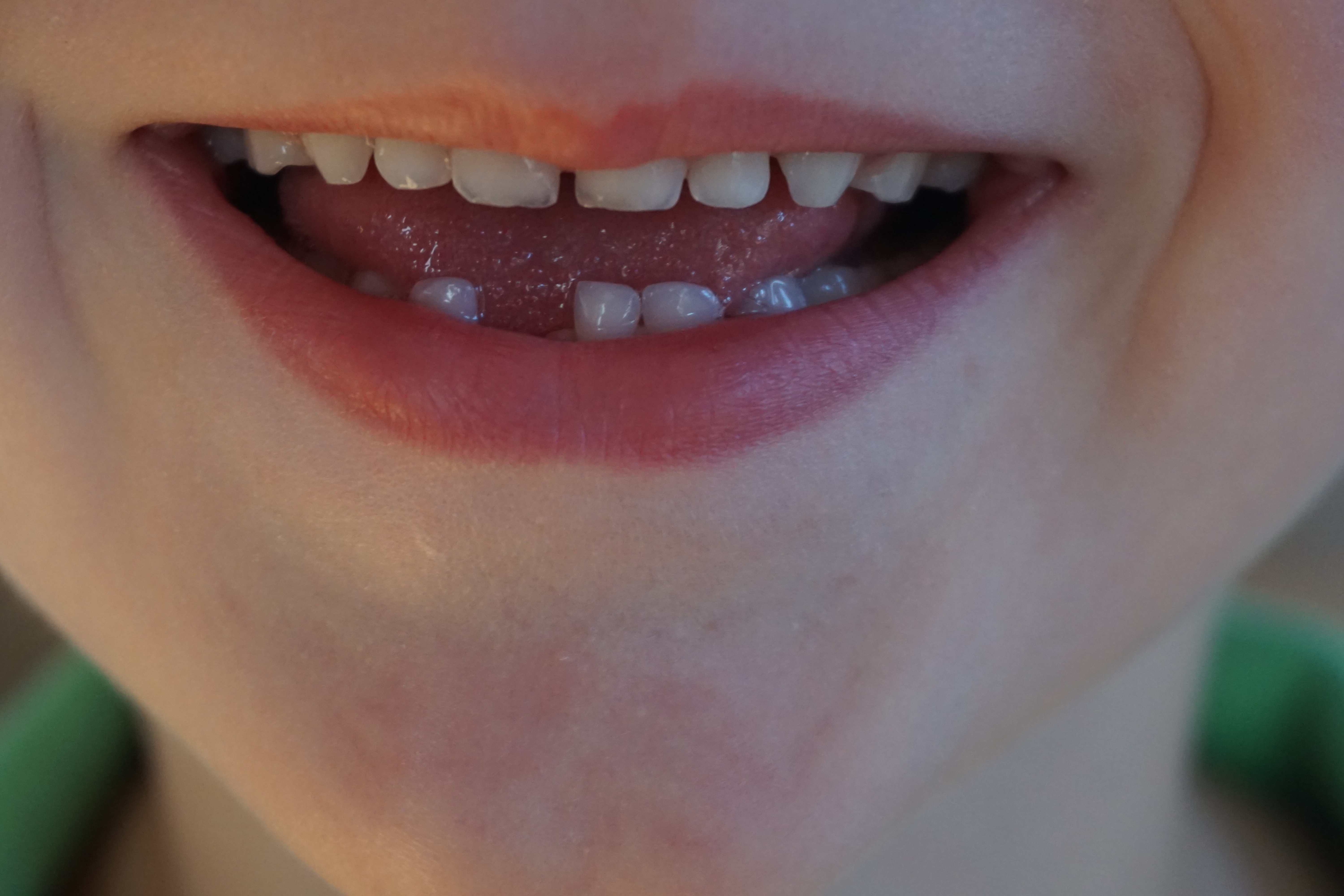 Sonrisa con dientes saludables