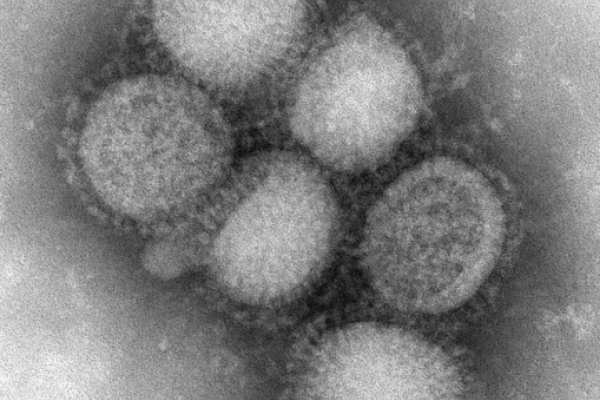 Imagen del virus al microscopio
