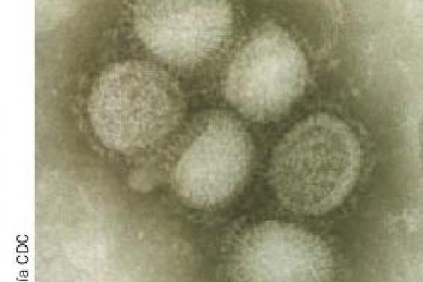Imagen del virus al microscopio