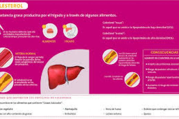 Infografía sobre el colesterol, causantes y consecuencias.