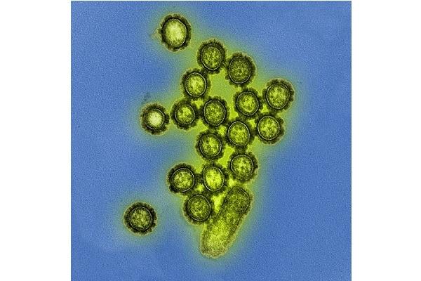 Microfotografía que muestra las partículas del virus H1N1 Influenza