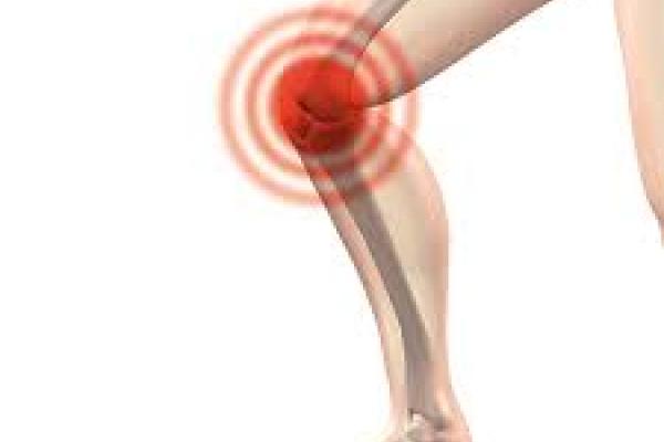 Dibujo de articulación de rodilla de una persona.
