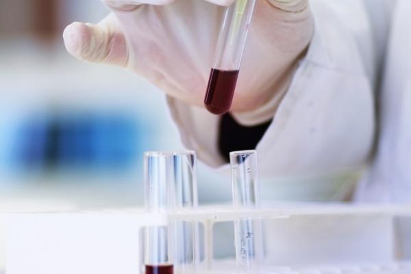 ¿Qué circula por nuestras venas y arterias?
