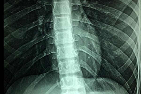Estructura externa e interna de la médula espinal