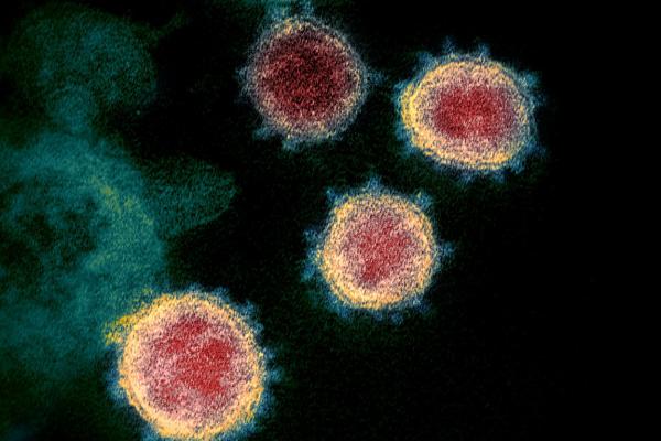 No es lo mismo virus que bacteria