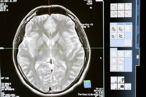 Aplicaciones médicas de las radiaciones ionizantes