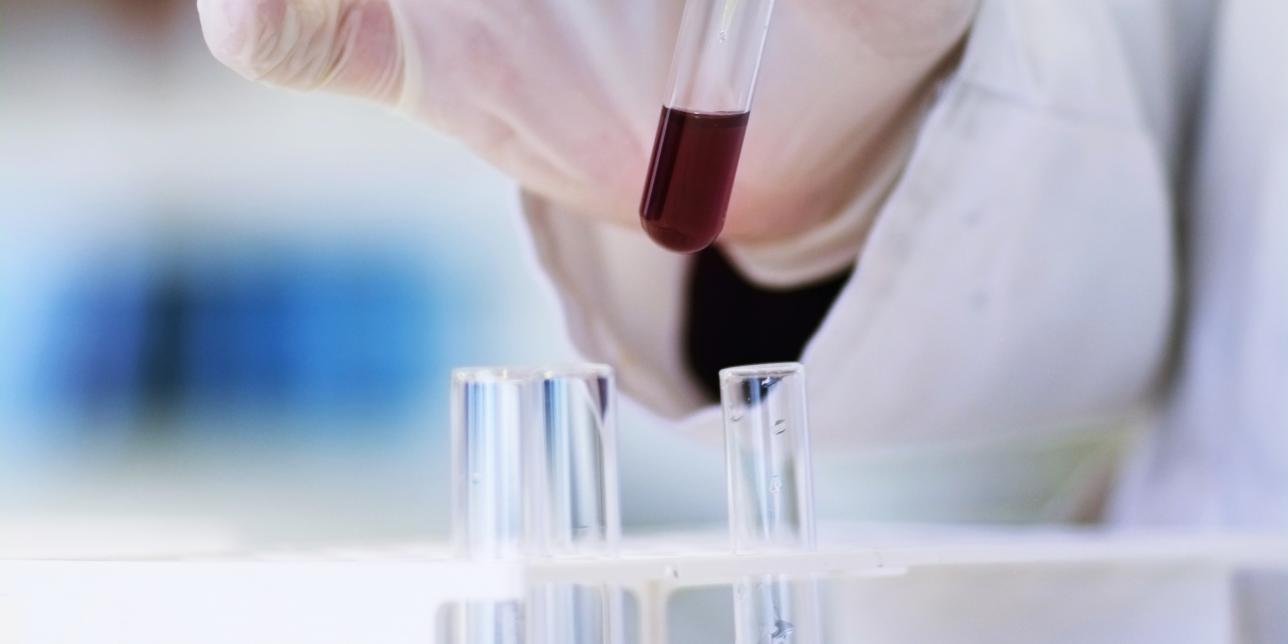 ¿Qué circula por nuestras venas y arterias?