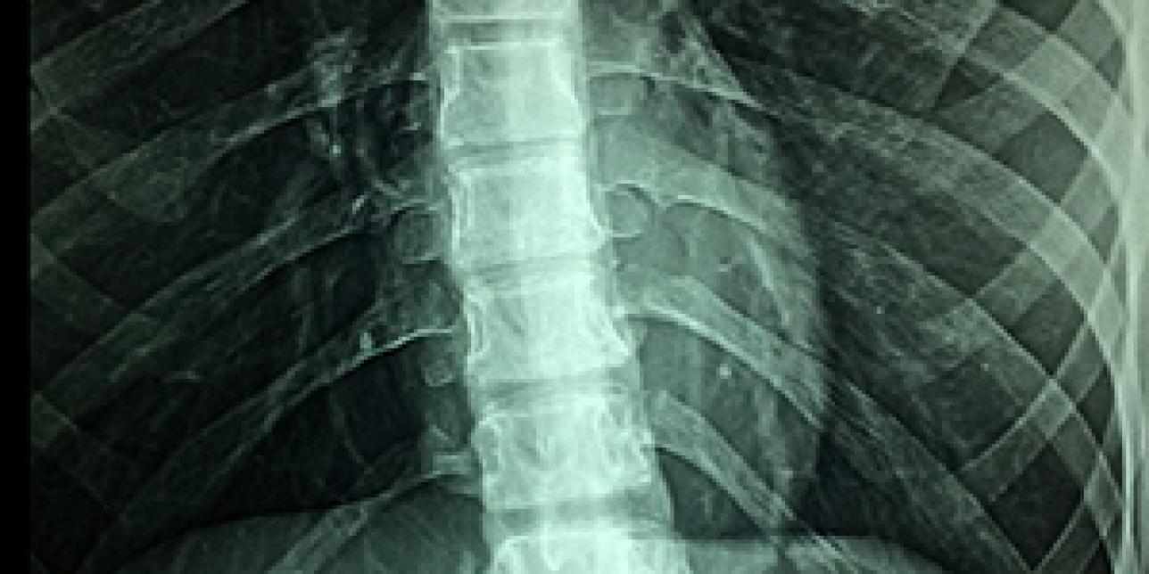 Estructura externa e interna de la médula espinal