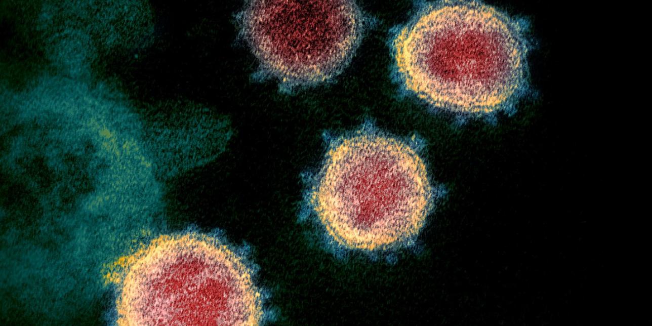 No es lo mismo virus que bacteria