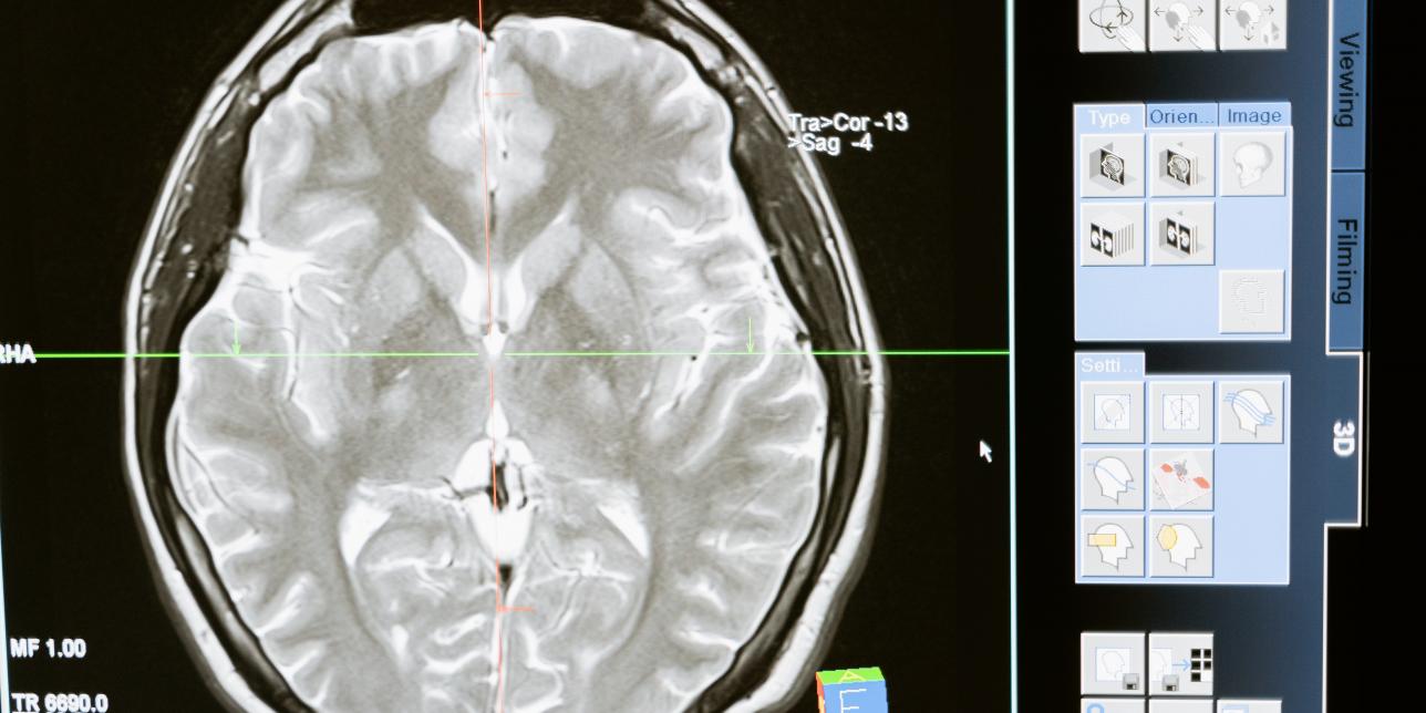 Aplicaciones médicas de las radiaciones ionizantes