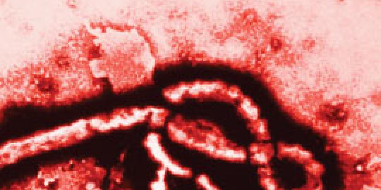 Ébola: ¿es un virus letal?